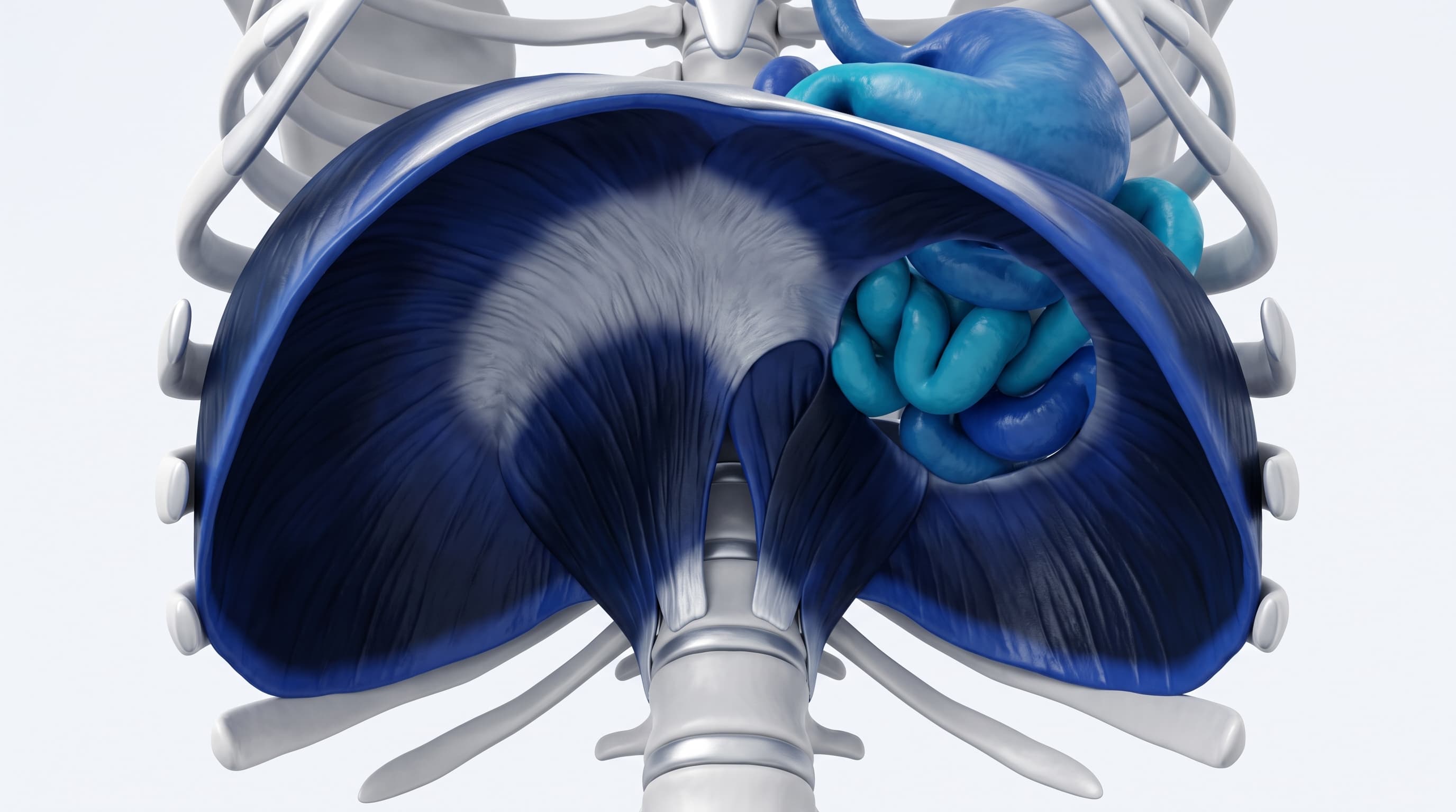 Ilustración Médica - Hernia Diafragmática y Eventración Diafragmática